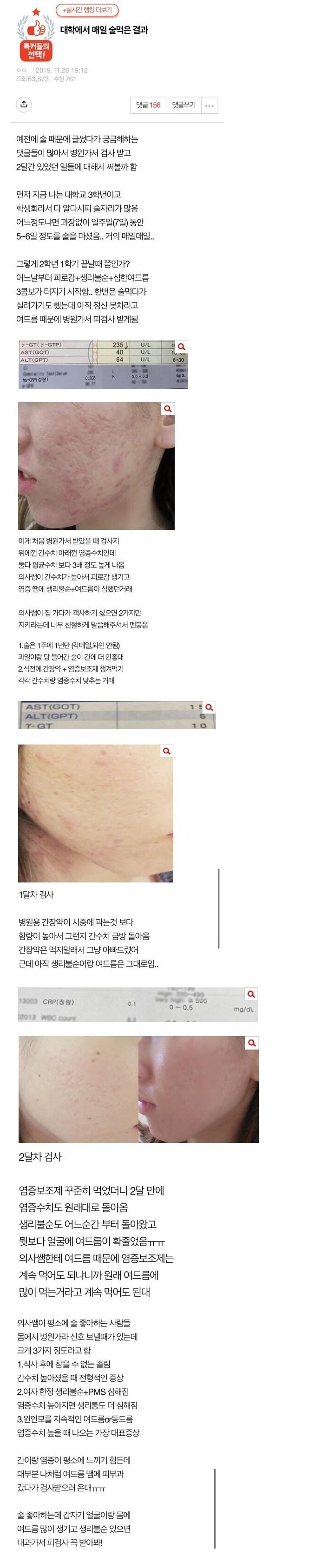 매일 술먹은 여대생 몸상태