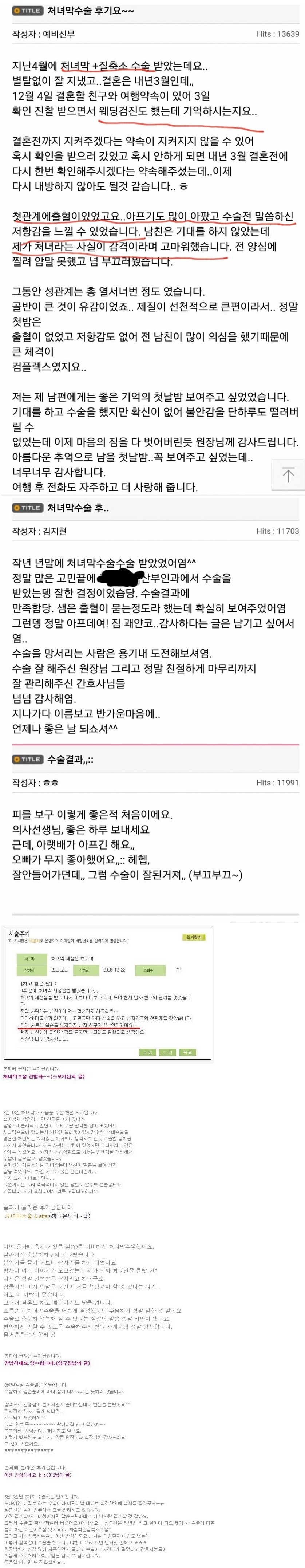 싱글벙글 수술후기