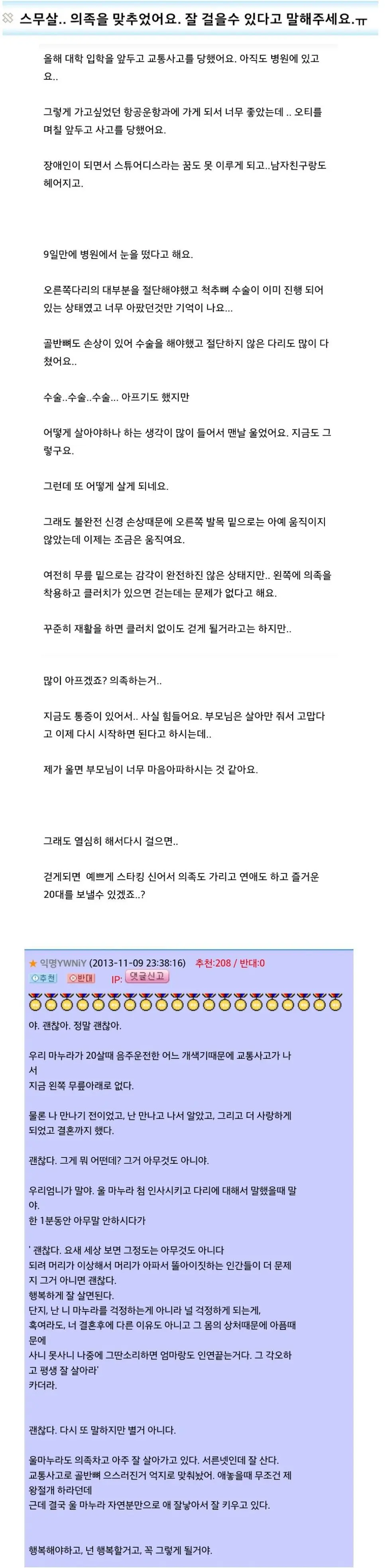 20대에 의족을 하게된 여성