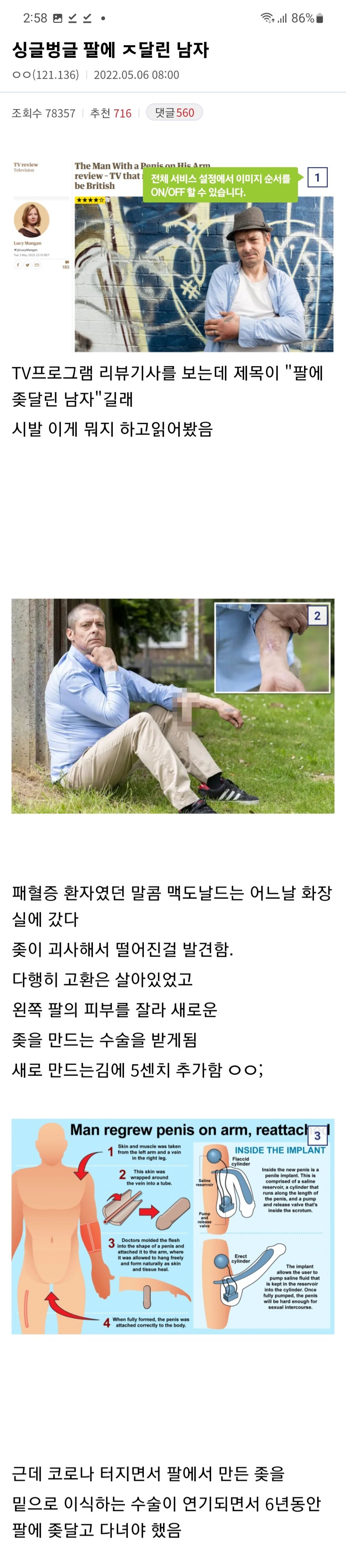 팔에 ㅈ달린 남자