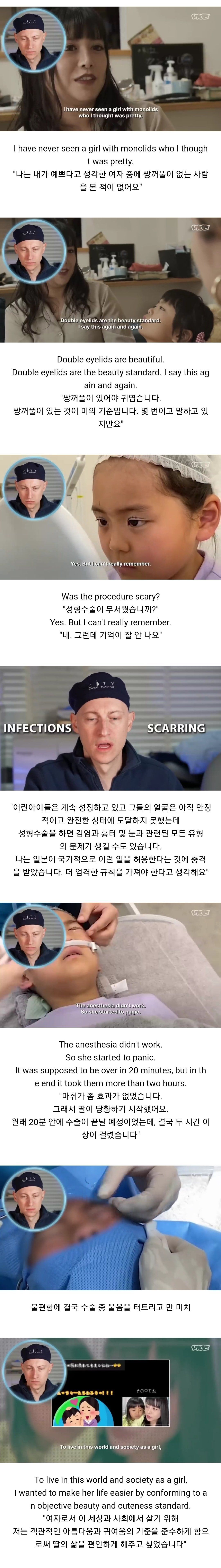 성형수술을 받는 일본 어린아이들