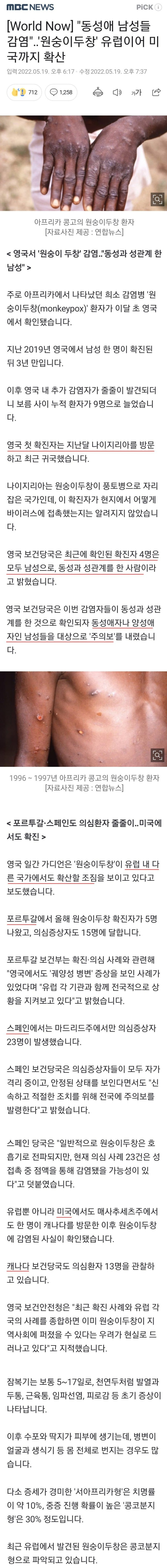 원숭이 두창 확산