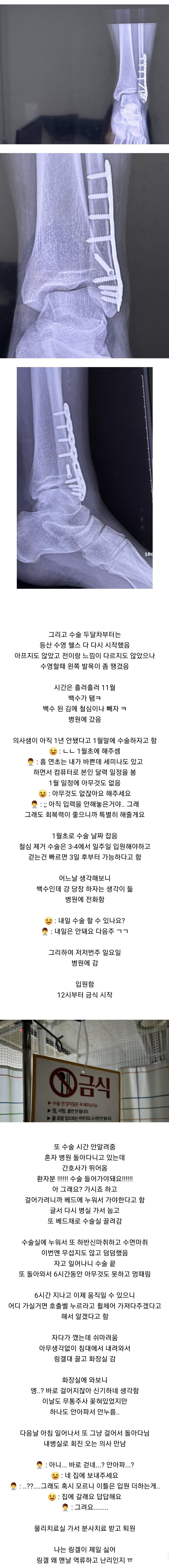 발목 부러졌는데도 몰랐던 여자 후기