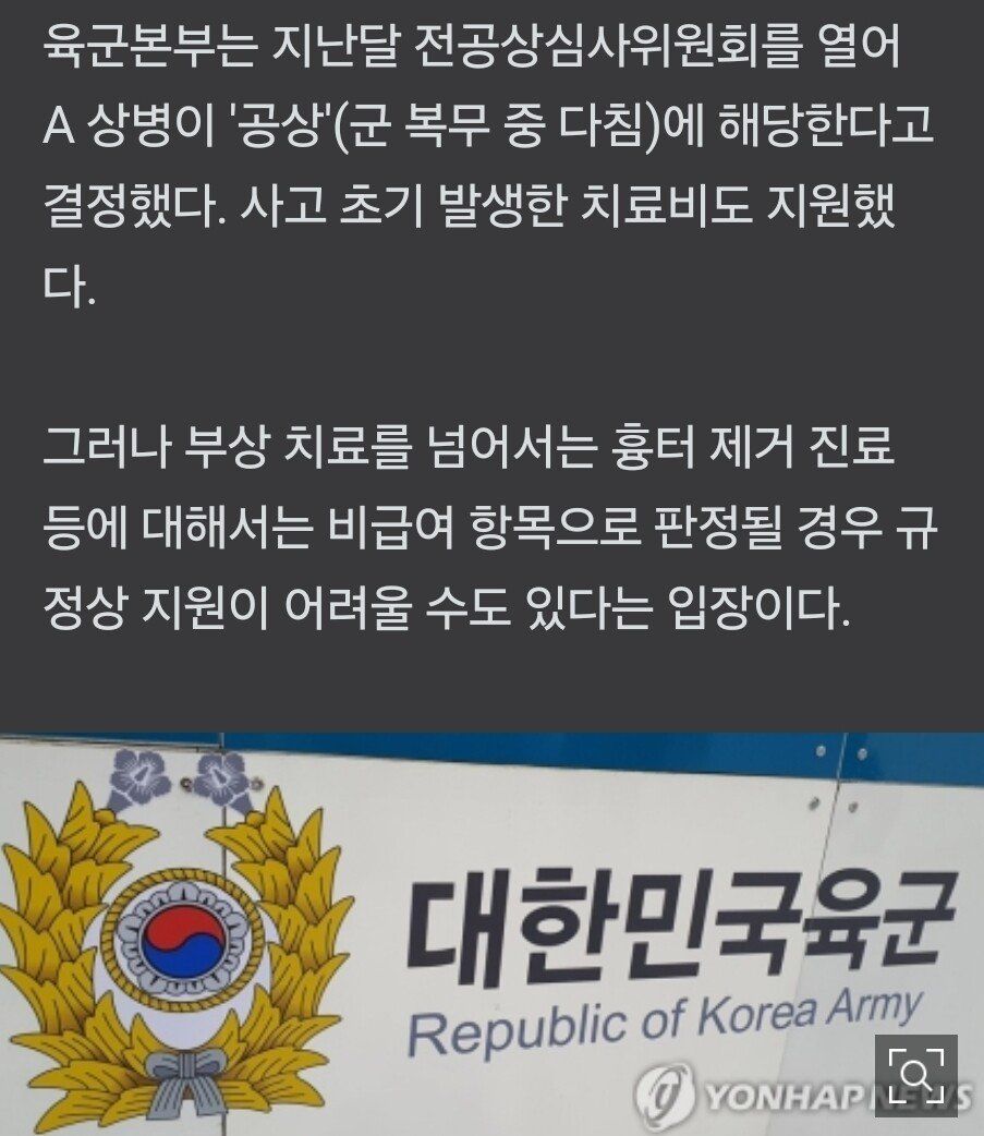 군용차 폐배터리 폭발로 20살 병사 다쳤는데…軍·제조사 '잘못 없다'