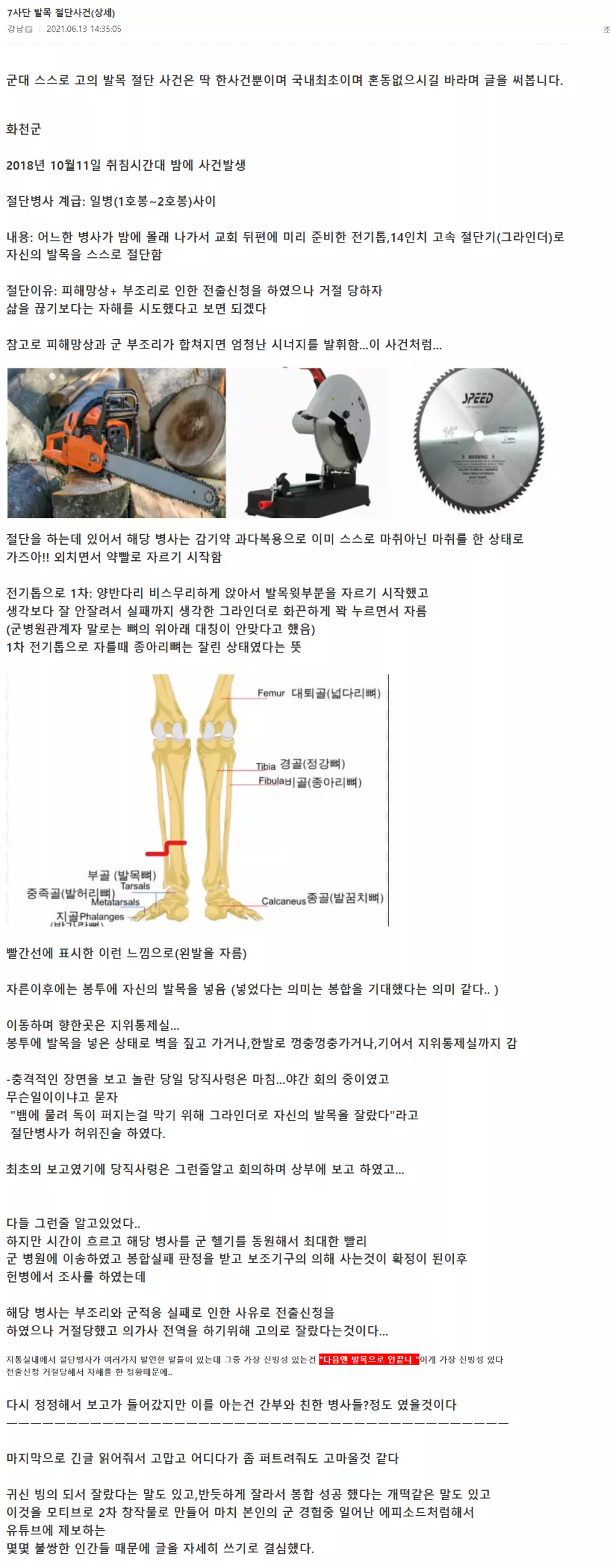 스스로 발목을 자른 군인썰