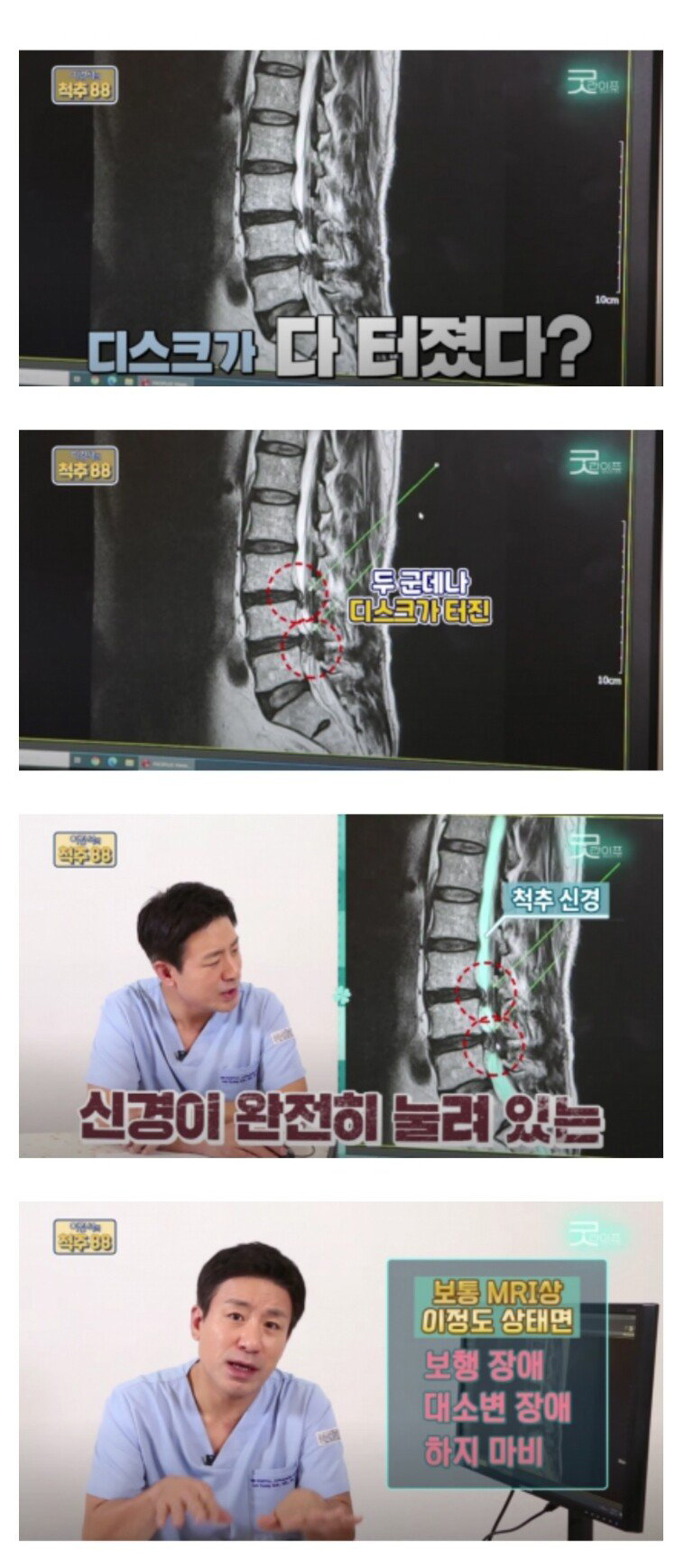 코어운동의 중요성