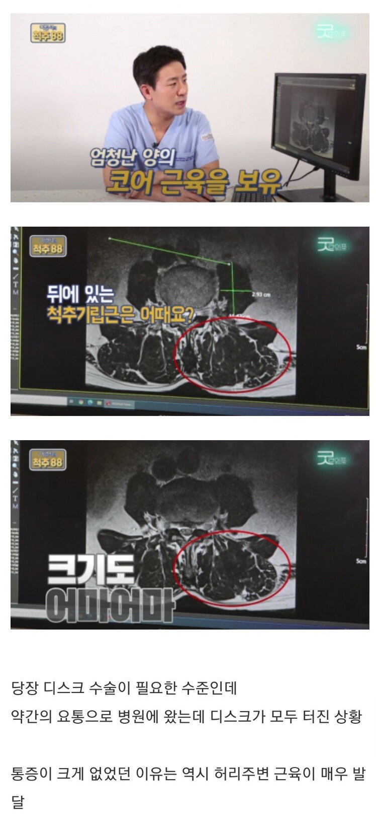 코어운동의 중요성