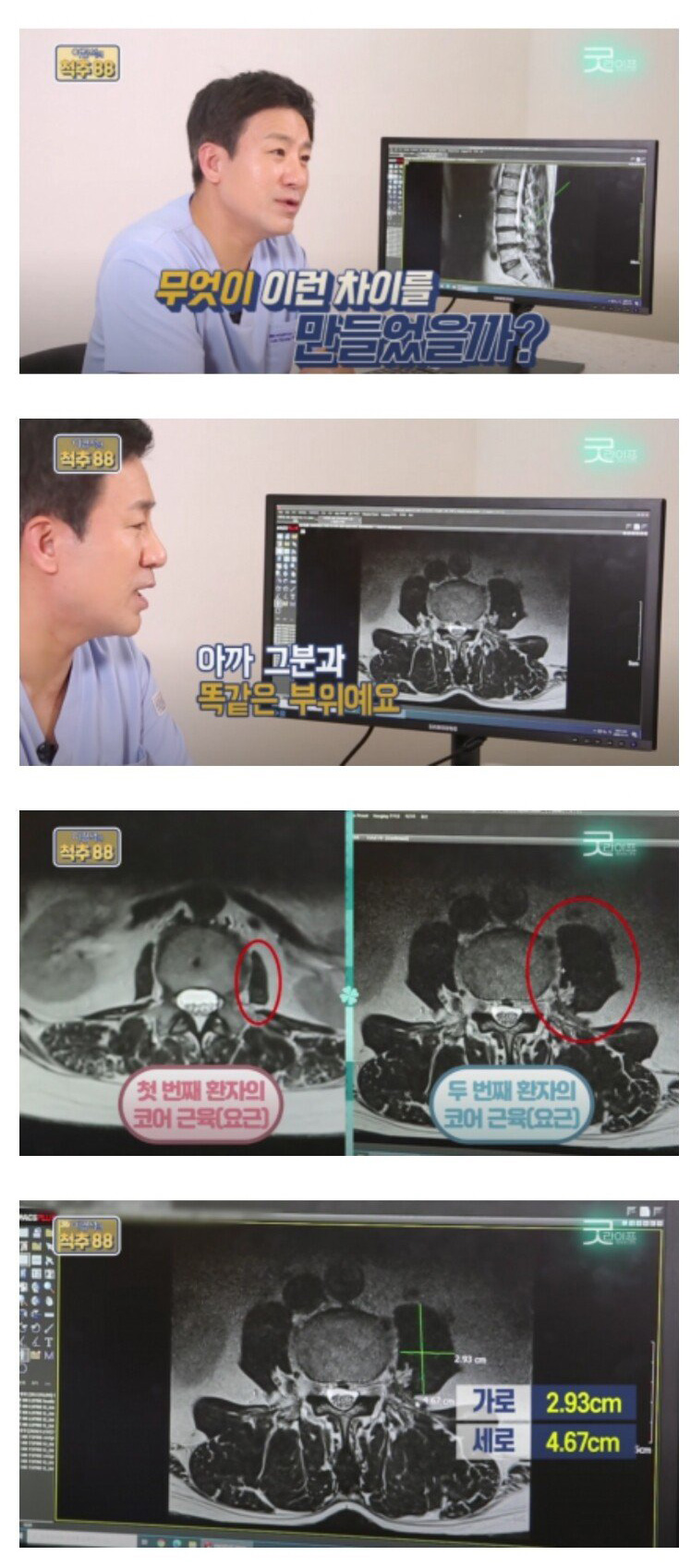 코어운동의 중요성