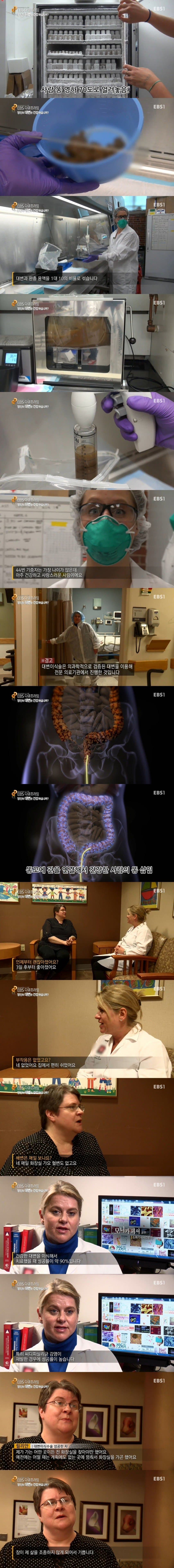 변비에 효과적이라는 대변 이식술