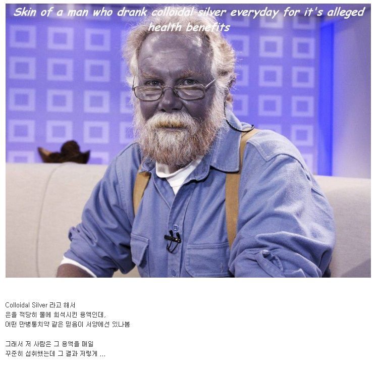 은에 중독된 사람.