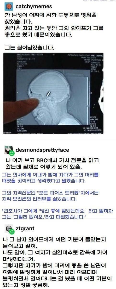 유부남이 두통을 호소하는 이유