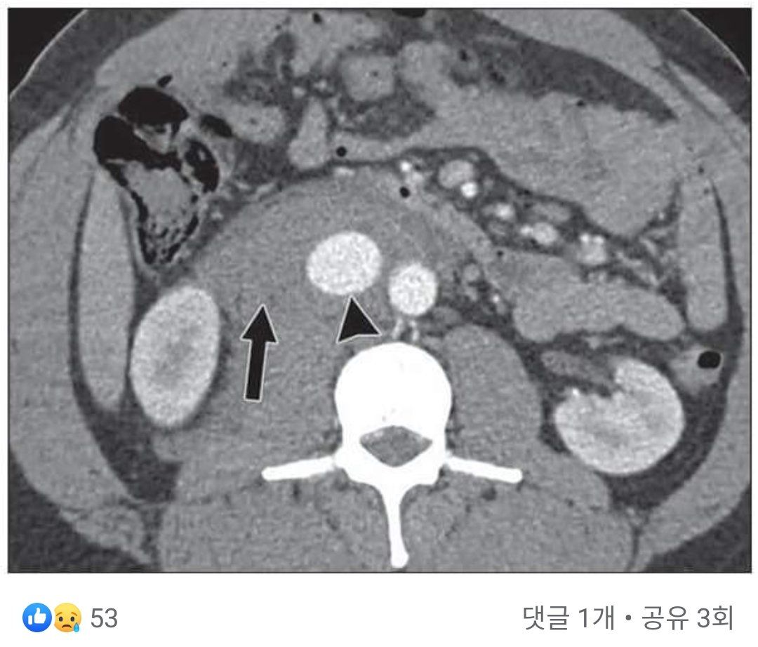 응급환자를 앞에 둔 의사의 딜레마