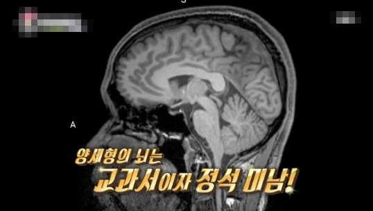 양세형이 창의적일 수밖에 없는 과학적인 근거