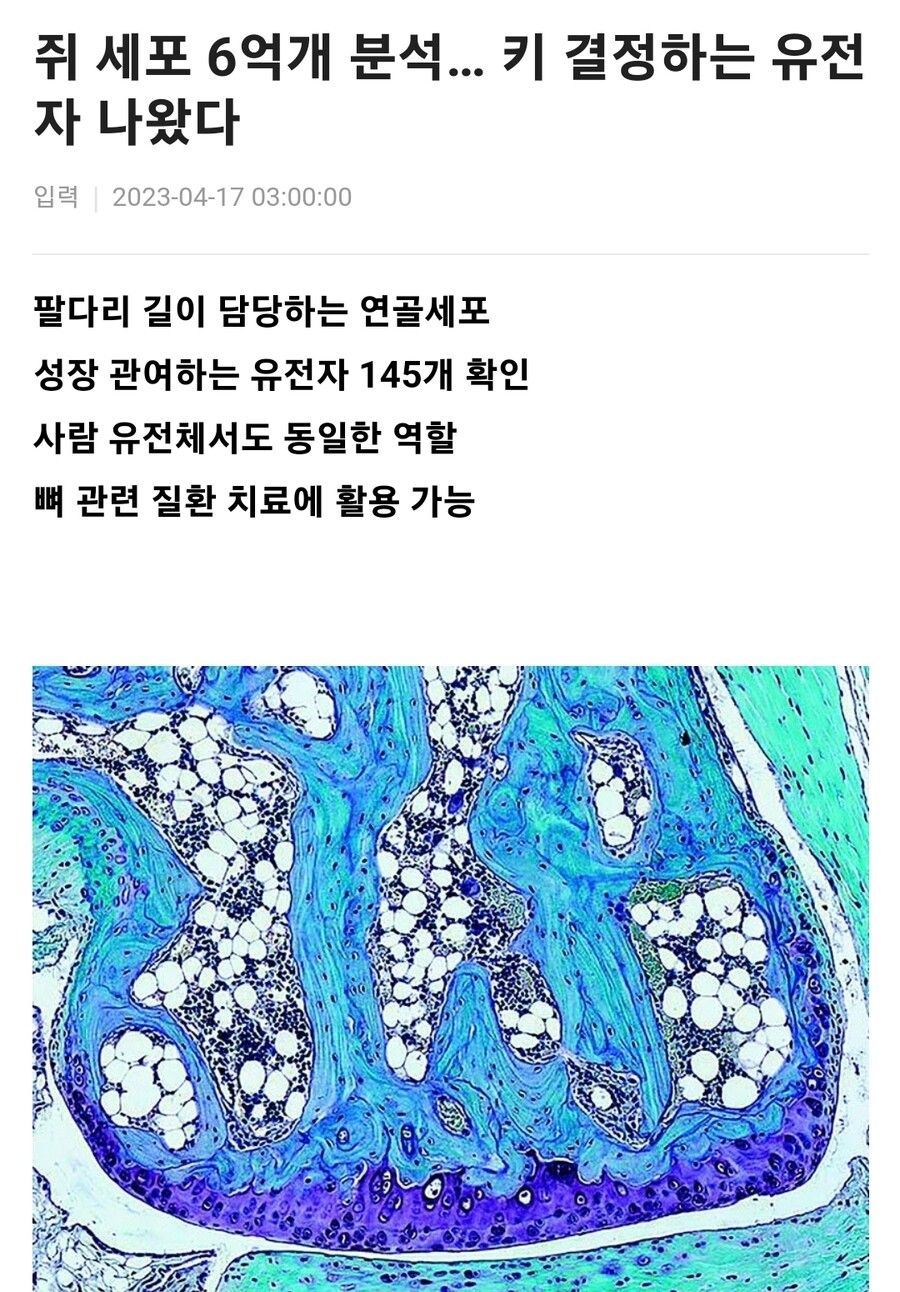 키 결정하는 유전자 발견