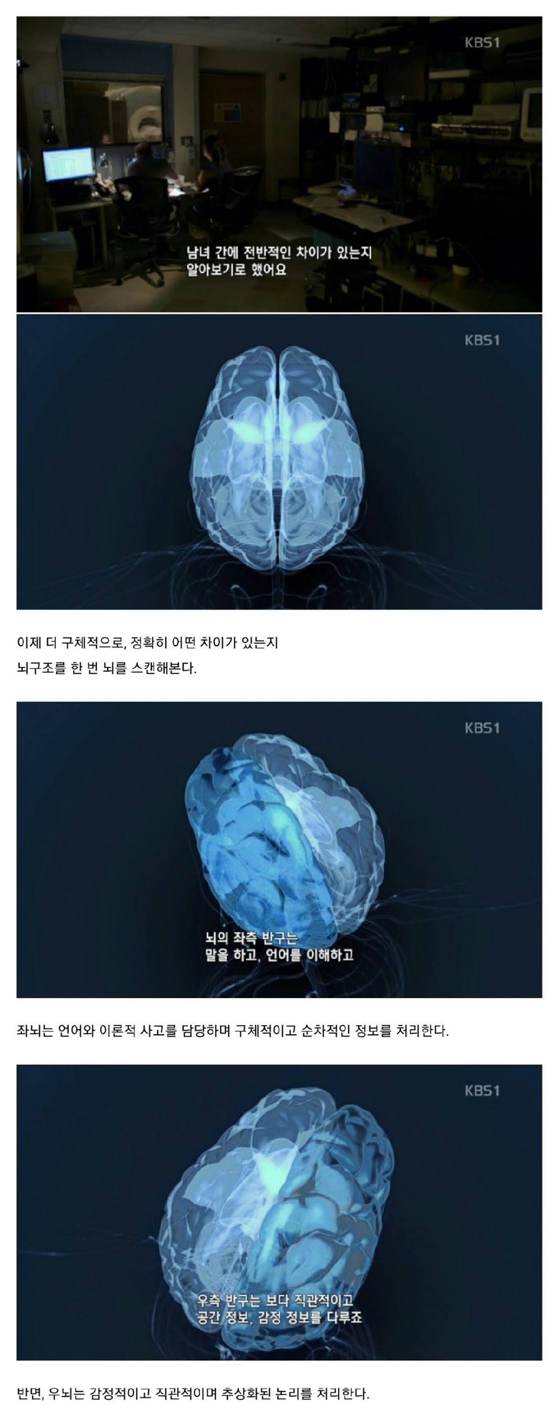 남자와 여자의 뇌구조 차이