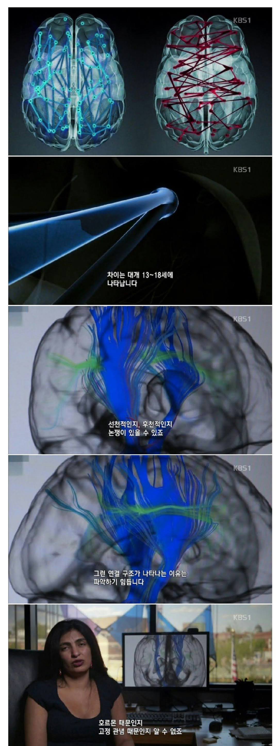 남자와 여자의 뇌구조 차이