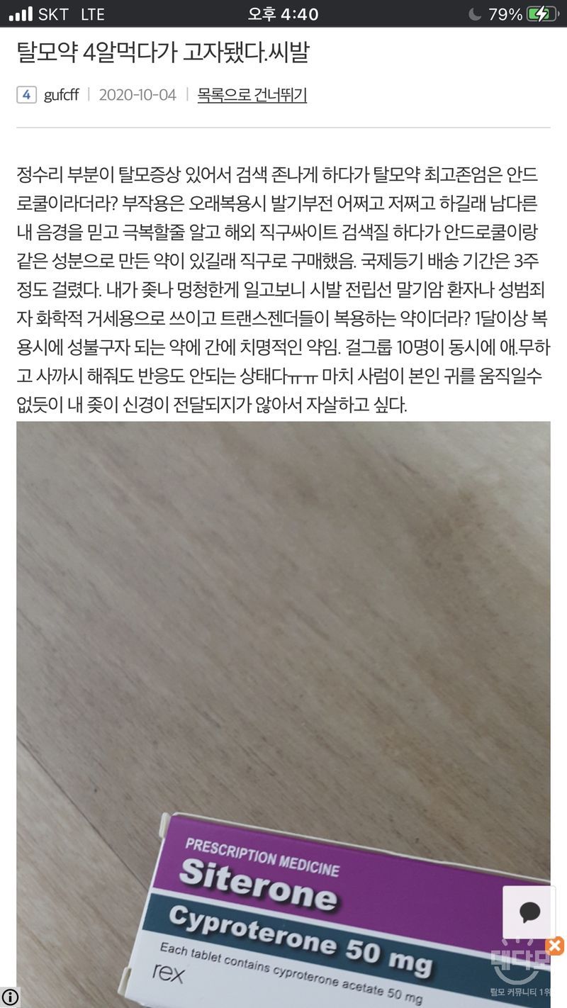 탈모치료 하려다 고자가 된 남자