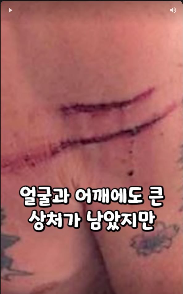 흑곰과 싸워서 이긴 60대 전직복서