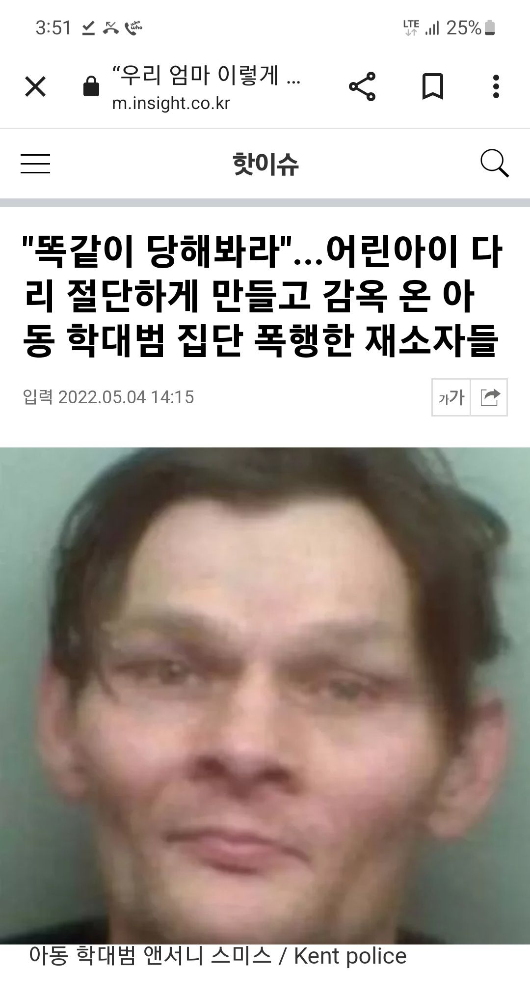 자기 아들 폭행해 다리 절단시킨 아동 학대범 재소자들에 의해 똑같이 당함