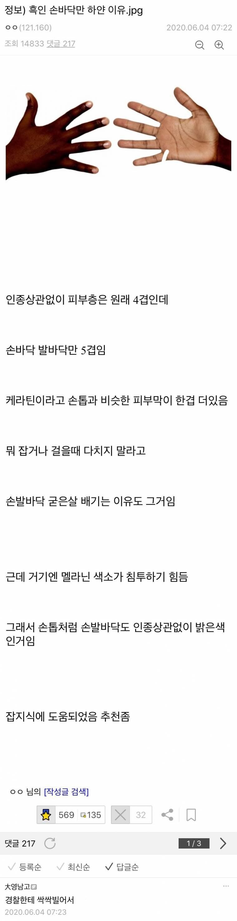 흑인이 손바닥만 하얀 이유