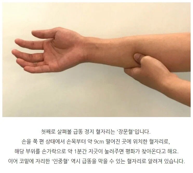 급똥 막아주는 장문혈 후기