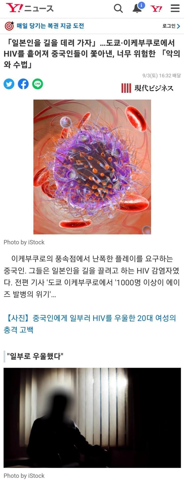 일본 에이즈 비상