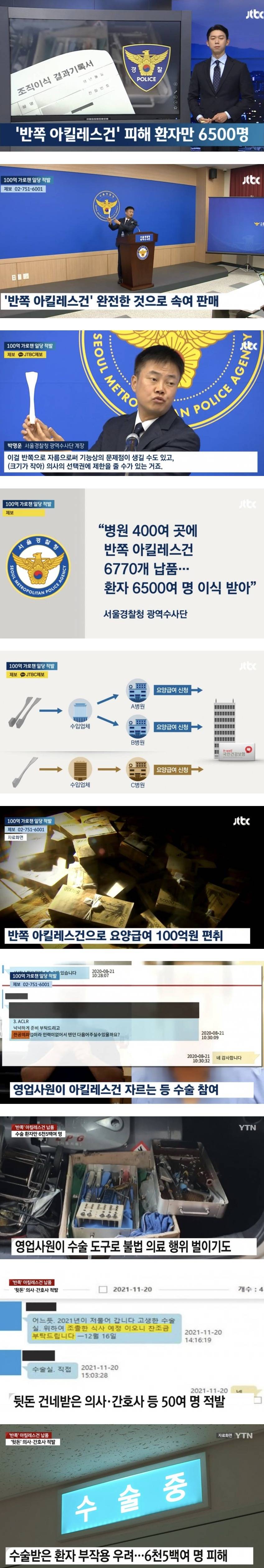 대리수술도 모자라 반쪽 아킬레스건까지