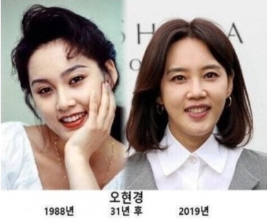 거짓말 같은 연예인들 얼굴 변화