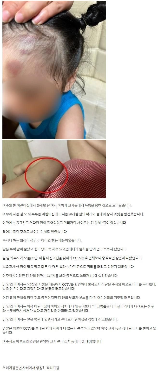 여수 어린이집에서 20개월 여아 폭행