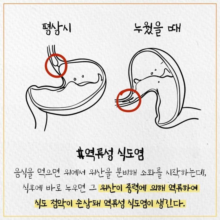 먹고 바로 누으면 위험한 이유