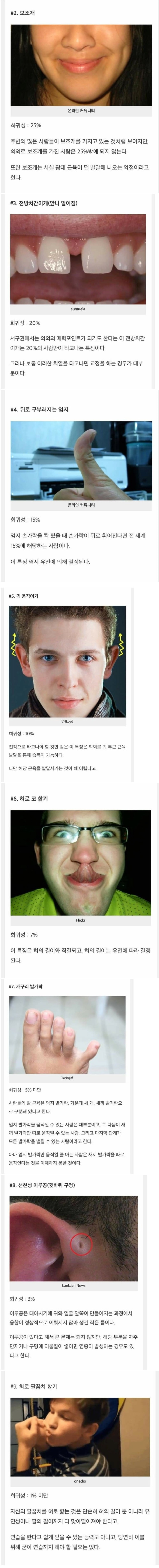 희귀성으로보는 인체의 신비.