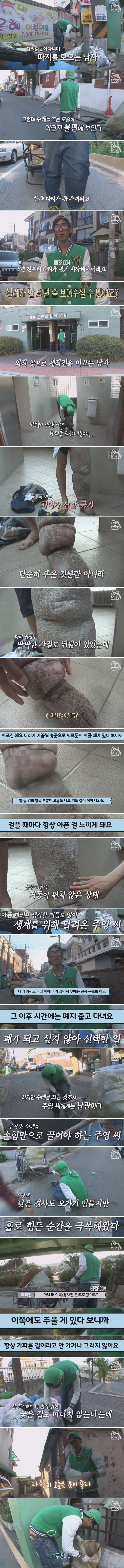 살이 찢기는 고통을 참으며 매일 폐지 줍는 남자