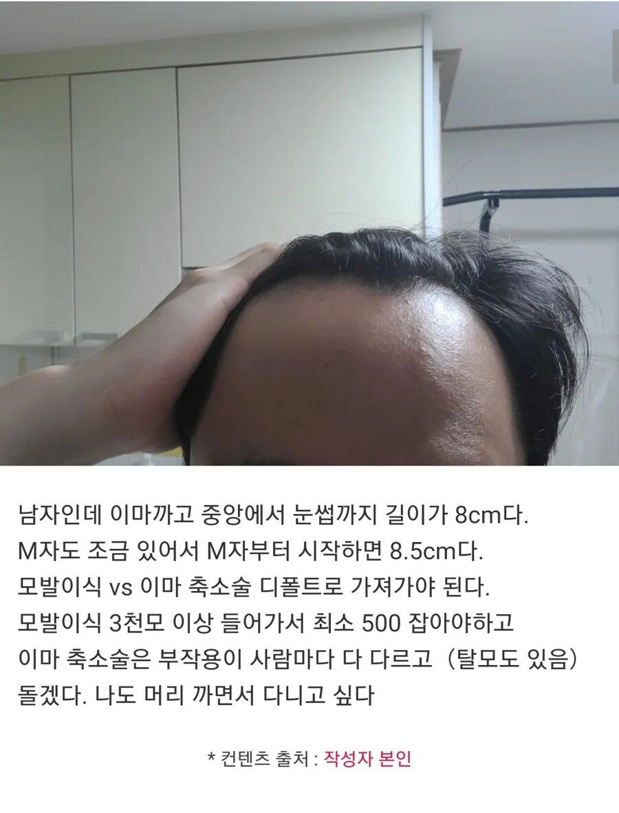 이마 8cm다... 자괴감 든다