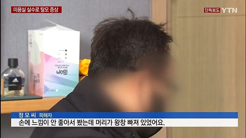 미용실 실수로 탈모 증상