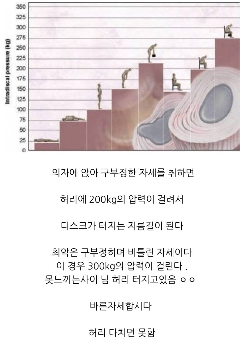 척추의 요정이 조언하는 글.