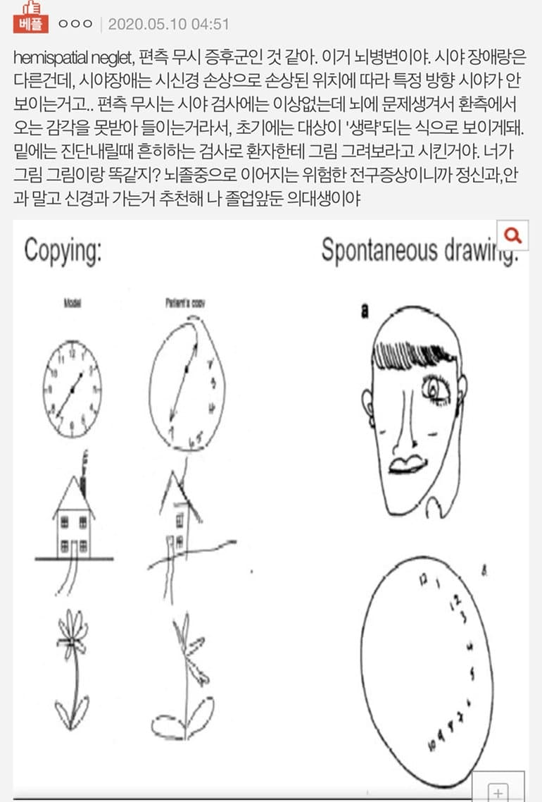 눈이 한쪽밖에 없는 옆집 아주머니