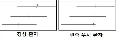 눈이 한쪽밖에 없는 옆집 아주머니