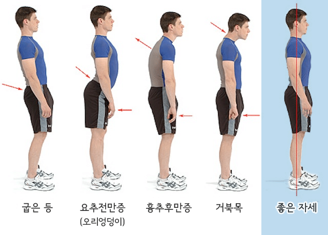 목, 척추에 안 좋다는 자세.