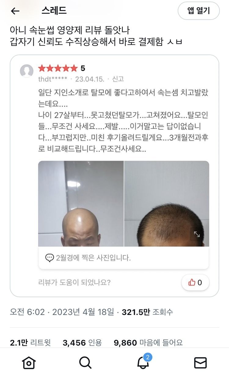 오늘 트위터에서 난리난 기적의 발모제!