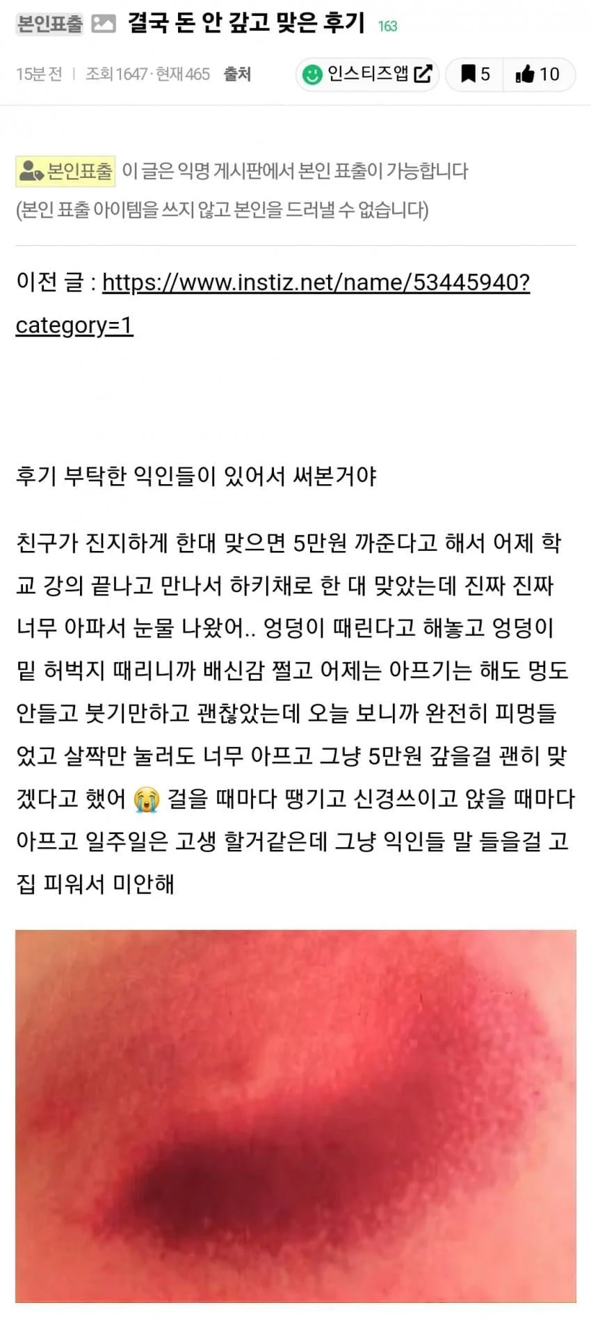 5만원갚기 대신 한대 맞기