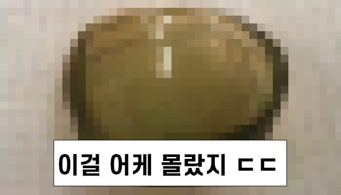 67세 할머니 눈에서 나온 물건의 정체