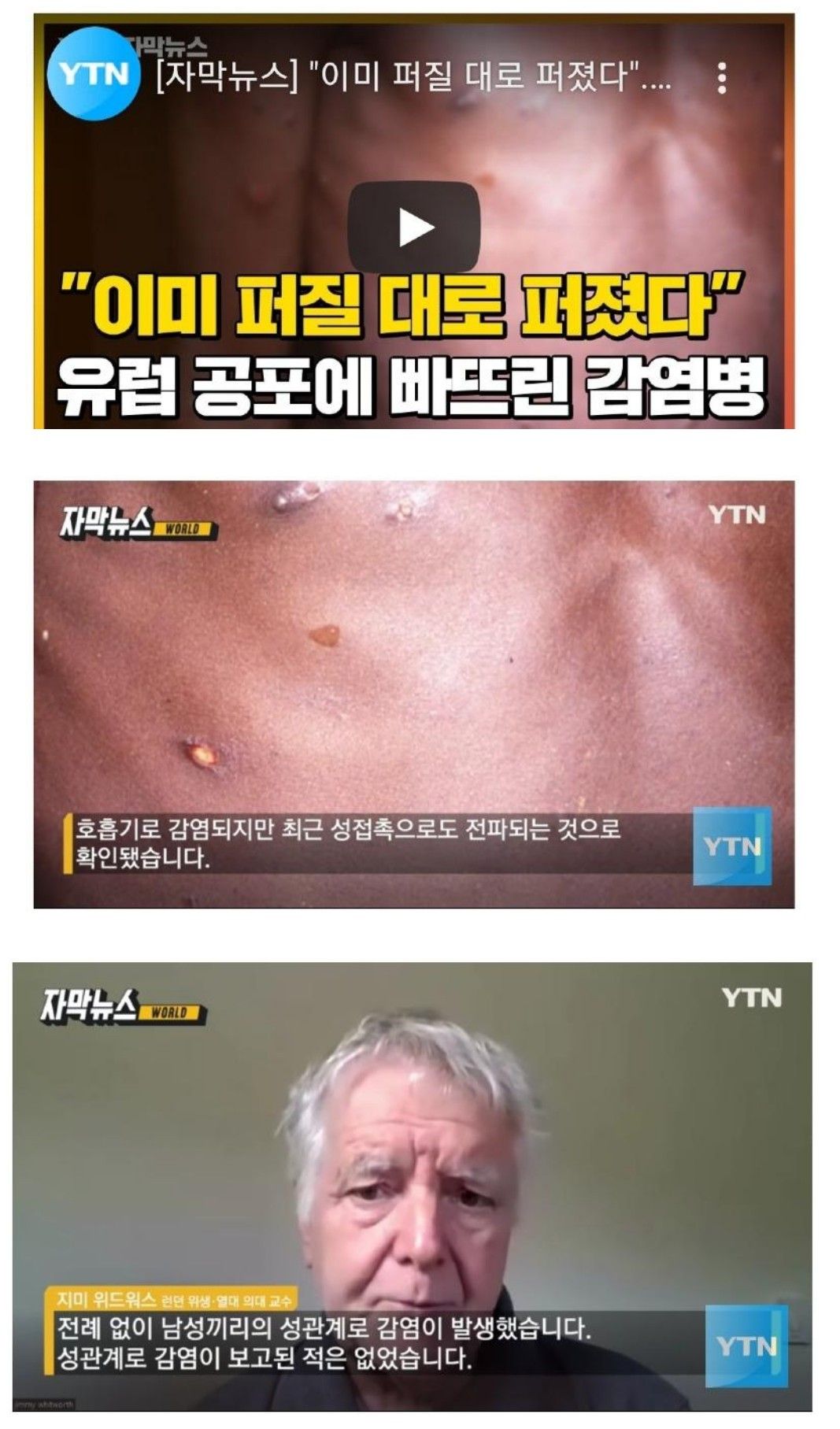 최신 유럽감염병 비상 ...