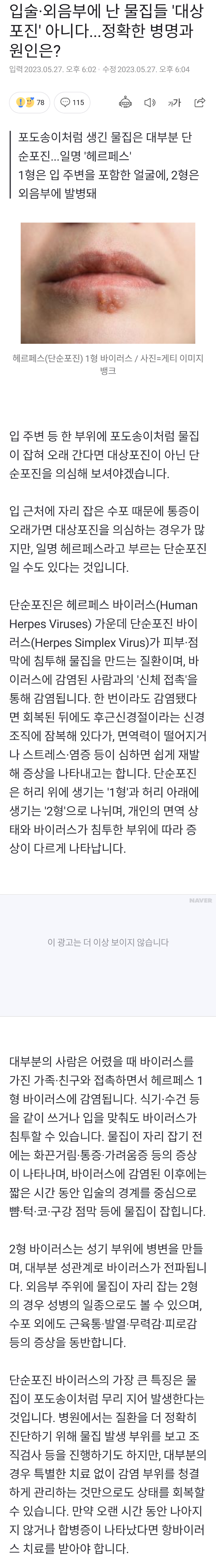 입술 물집