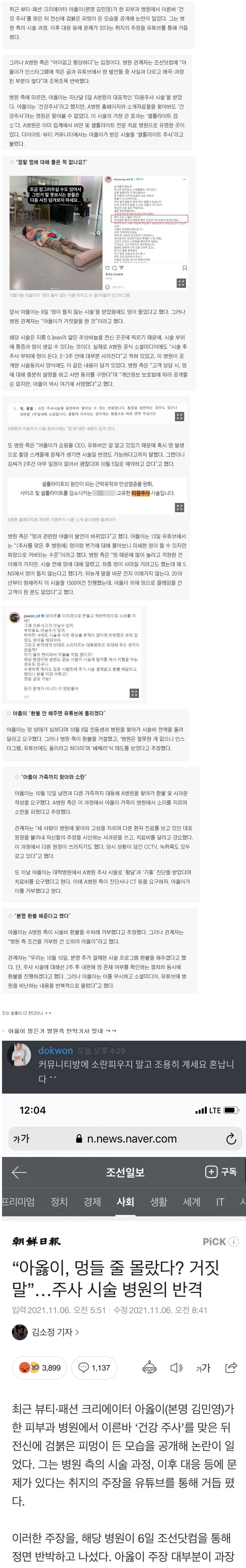 건강주사 맞고 온몸에 멍 들었다던 사건