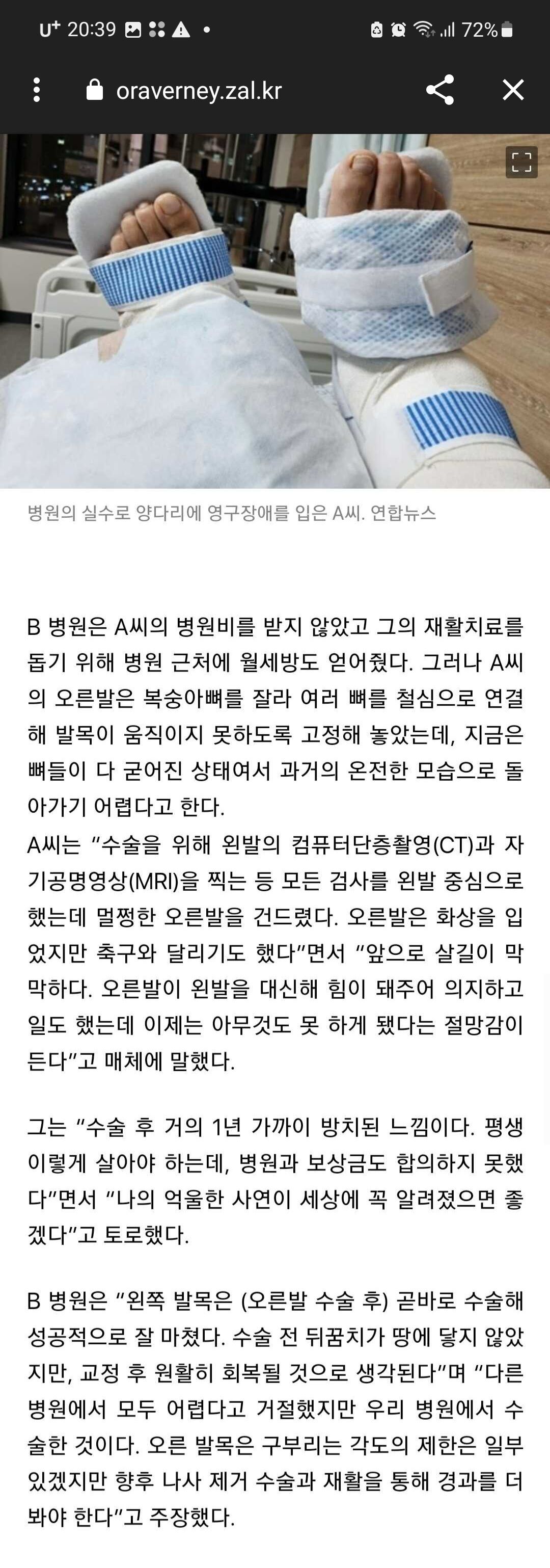 서울 의사 착각하고 멀쩡한 다리 절단 양쪽다 불구 됨