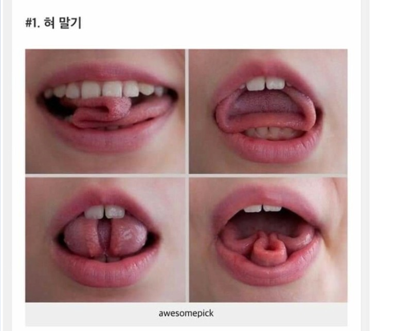 희귀성으로보는 인체의 신비.