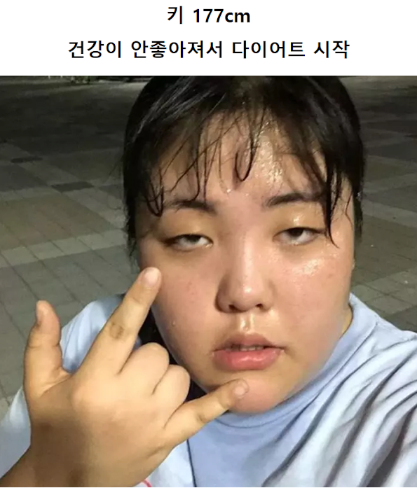 최고의 성형은 다이어트