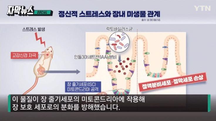 흔한데 원인조차 밝혀지지 않았던 과민성 대장증후군 근황