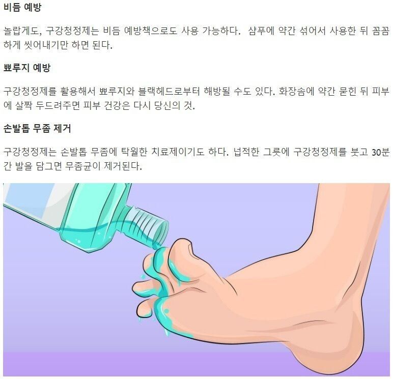 리스테린에 발을 30분간 담그면 무좀균이 죽는다